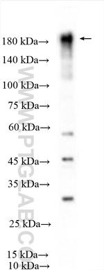 TIAM1 Antibody in Western Blot (WB)