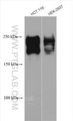 TIAM1 Antibody in Western Blot (WB)