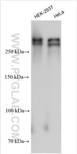 ANKRD17 Antibody in Western Blot (WB)