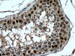 FTSJD2 Antibody in Immunohistochemistry (Paraffin) (IHC (P))