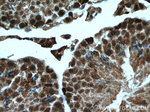 FTSJD2 Antibody in Immunohistochemistry (Paraffin) (IHC (P))