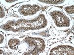 FTSJD2 Antibody in Immunohistochemistry (Paraffin) (IHC (P))