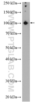 FTSJD2 Antibody in Western Blot (WB)