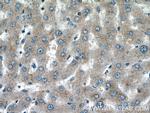 ABCG5 Antibody in Immunohistochemistry (Paraffin) (IHC (P))