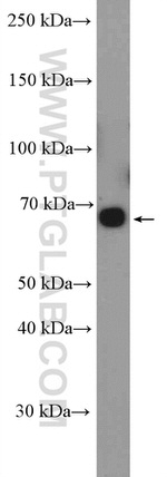 ABCG5 Antibody in Western Blot (WB)