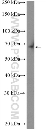 ABCG5 Antibody in Western Blot (WB)