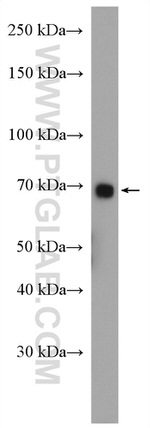 ABCG5 Antibody in Western Blot (WB)