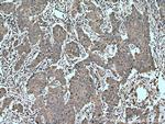 TNFRSF17 Antibody in Immunohistochemistry (Paraffin) (IHC (P))