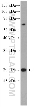 TNFRSF17 Antibody in Western Blot (WB)