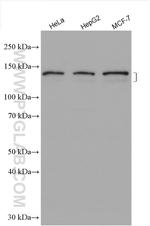 ABCB4 Antibody in Western Blot (WB)