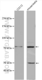 ABI3BP Antibody in Western Blot (WB)