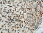 ECHDC1 Antibody in Immunohistochemistry (Paraffin) (IHC (P))