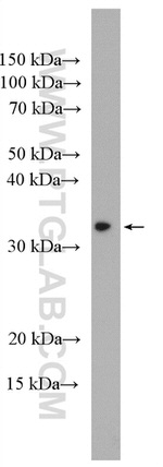 ECHDC1 Antibody in Western Blot (WB)
