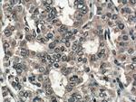 SLC24A5 Antibody in Immunohistochemistry (Paraffin) (IHC (P))