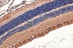 PRPF31 Antibody in Immunohistochemistry (Paraffin) (IHC (P))