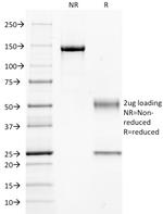 Guanine nucleotide-binding protein alpha-q/GNAQ/G-ALPHA-q Antibody in SDS-PAGE (SDS-PAGE)