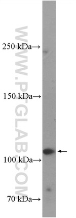 ANK3 Antibody in Western Blot (WB)