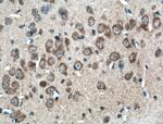 ANK3 Antibody in Immunohistochemistry (Paraffin) (IHC (P))