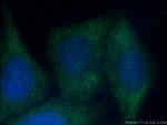 YTHDC2 Antibody in Immunocytochemistry (ICC/IF)