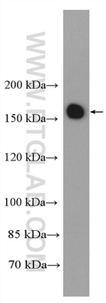 YTHDC2 Antibody in Western Blot (WB)