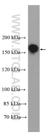 YTHDC2 Antibody in Western Blot (WB)