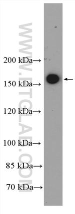 YTHDC2 Antibody in Western Blot (WB)