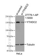 YTHDC2 Antibody in Western Blot (WB)