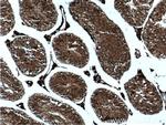 USP8 Antibody in Immunohistochemistry (Paraffin) (IHC (P))