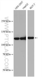 USP8 Antibody in Western Blot (WB)