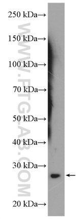 OSM Antibody in Western Blot (WB)