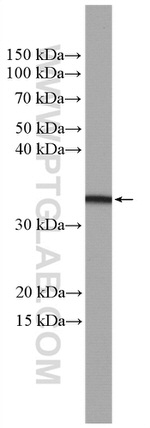 OSM Antibody in Western Blot (WB)