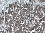 OSM Antibody in Immunohistochemistry (Paraffin) (IHC (P))