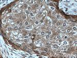 PARG Antibody in Immunohistochemistry (Paraffin) (IHC (P))