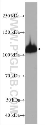 PARG Antibody in Western Blot (WB)