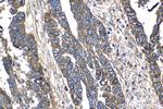 CD151 Antibody in Immunohistochemistry (Paraffin) (IHC (P))