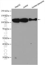 LAMP2 Antibody in Western Blot (WB)