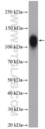 LAMP2 Antibody in Western Blot (WB)