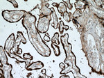 HSD17B1 Antibody in Immunohistochemistry (Paraffin) (IHC (P))