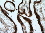 HSD17B1 Antibody in Immunohistochemistry (Paraffin) (IHC (P))