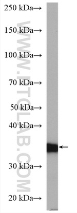 HSD17B1 Antibody in Western Blot (WB)