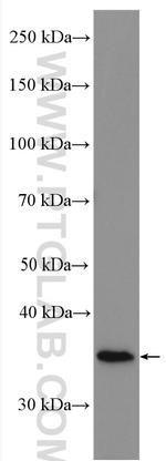 HSD17B1 Antibody in Western Blot (WB)