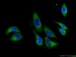 FMNL1 Antibody in Immunocytochemistry (ICC/IF)