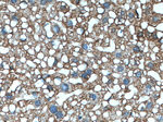 ABCC6 Antibody in Immunohistochemistry (Paraffin) (IHC (P))