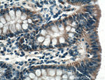 SLC25A46 Antibody in Immunohistochemistry (Paraffin) (IHC (P))