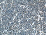 SLC25A46 Antibody in Immunohistochemistry (Paraffin) (IHC (P))