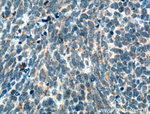 SLC25A46 Antibody in Immunohistochemistry (Paraffin) (IHC (P))