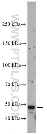 SLC25A46 Antibody in Western Blot (WB)