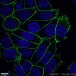 gamma catenin Antibody in Immunocytochemistry (ICC/IF)