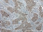 gamma catenin Antibody in Immunohistochemistry (Paraffin) (IHC (P))