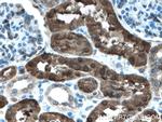 PBLD Antibody in Immunohistochemistry (Paraffin) (IHC (P))